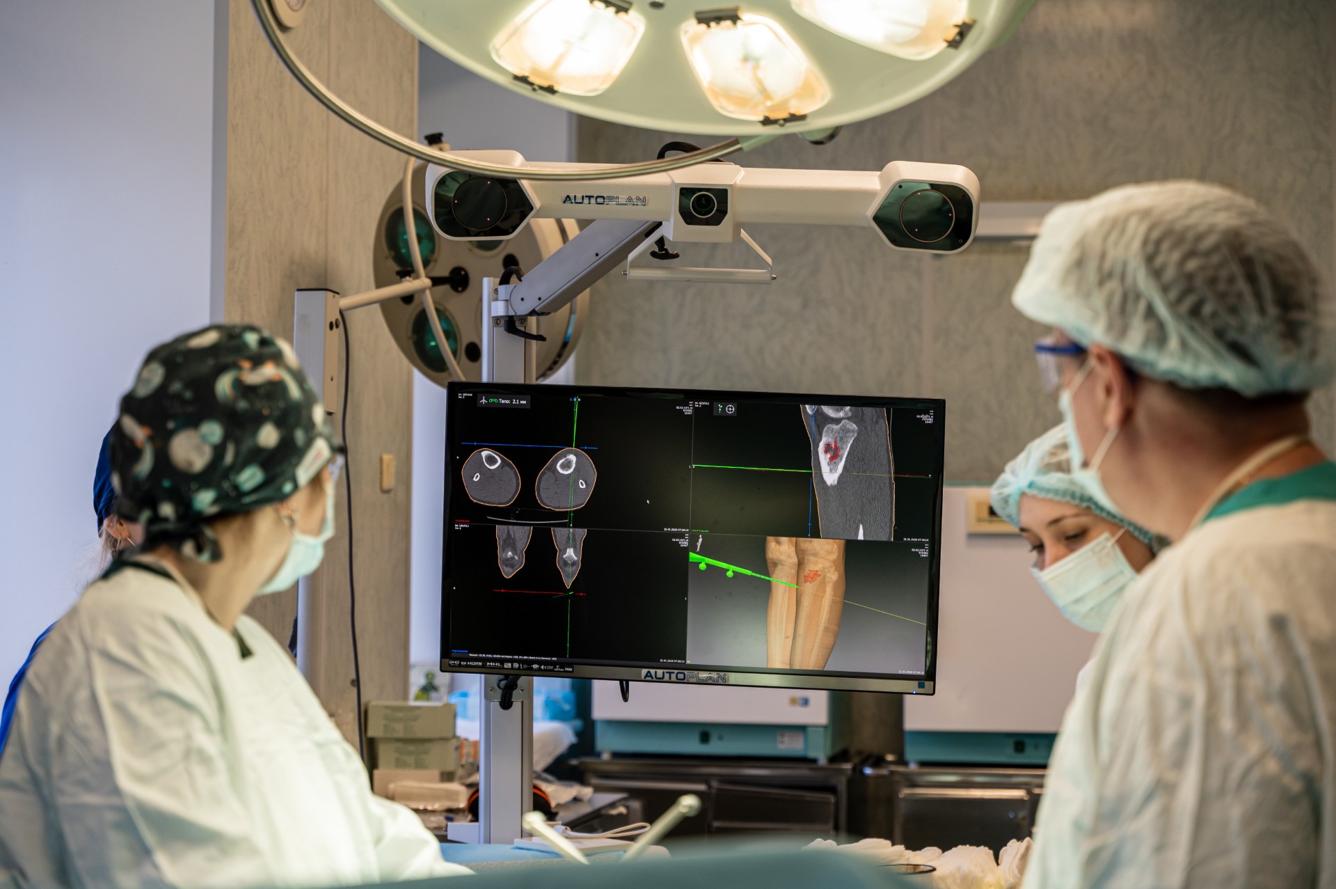 С применением AUTOPLAN («Автоплан») ИИР СамГМУ прооперировали пациента с хроническим остеомиелитом голени